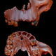 Digital reconstruction of a partial Homo antecessor cranium.